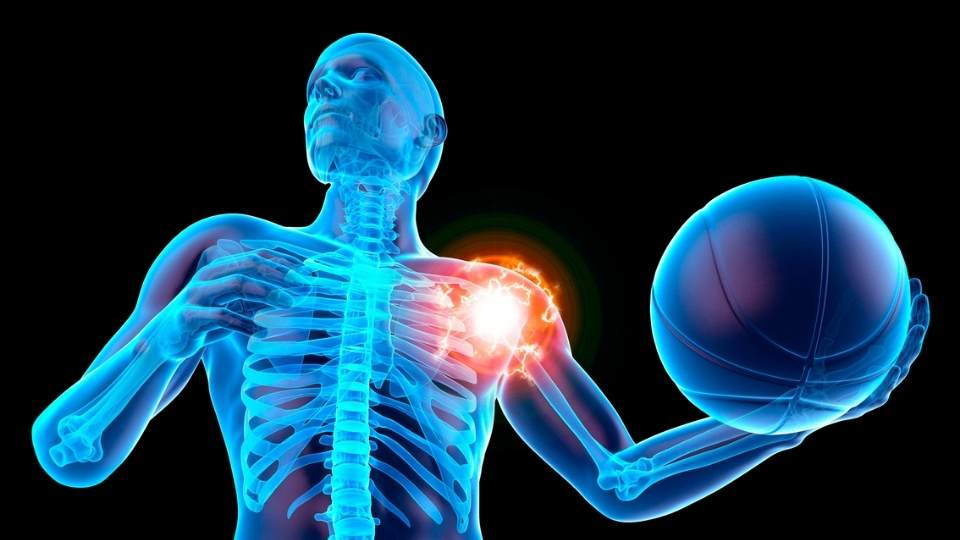 Frozen Shoulder Dublin Physio & Chiropractic