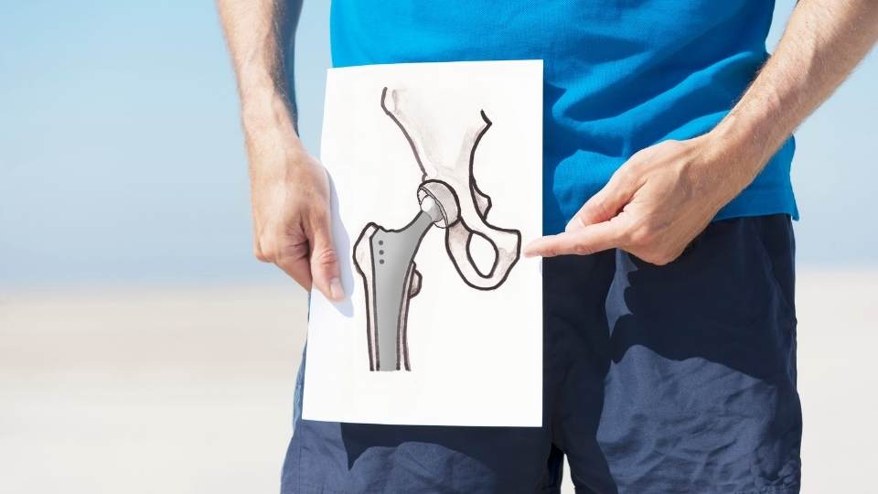 Hip Replacment Dublin Physio & Chiropractic