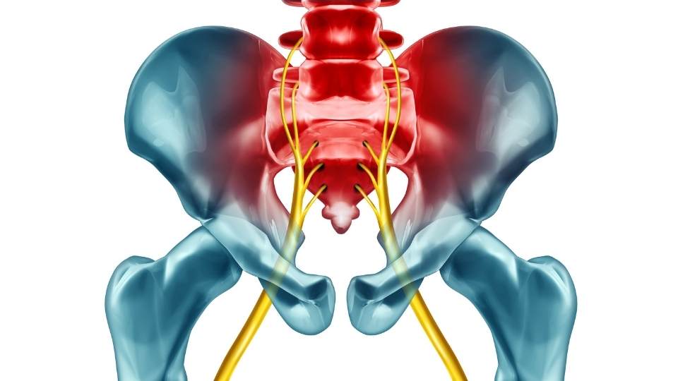 Sciatica Nerve Dublin Physio & Chiropractic