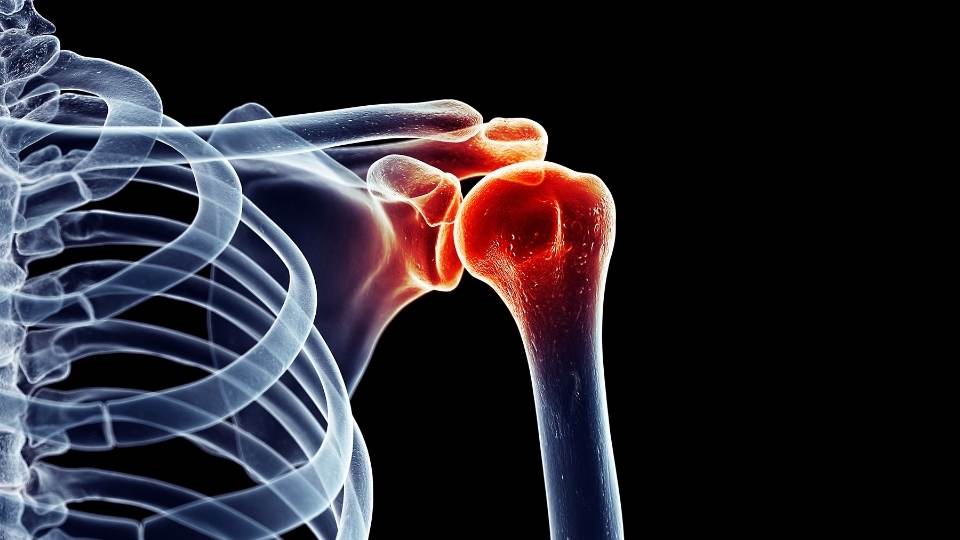 shoulder pain physio dublin ireland