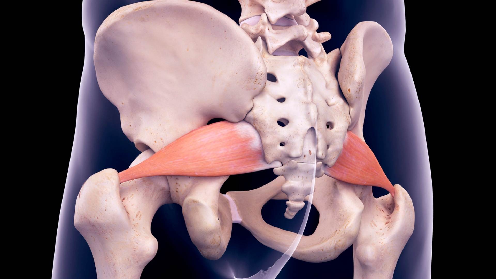 piriformis syndrome dublin physio & chiropractic