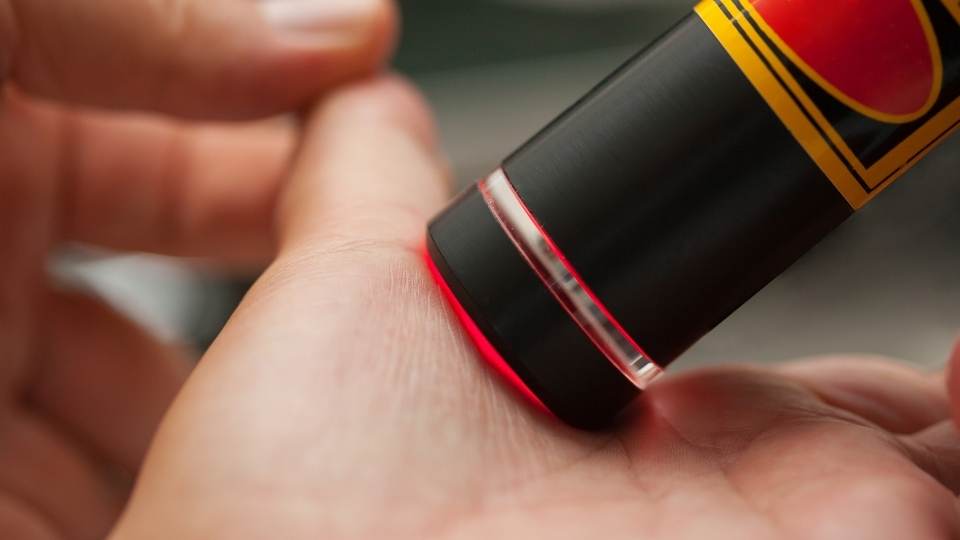 raynaud's disease dublin physio & chiropractic
